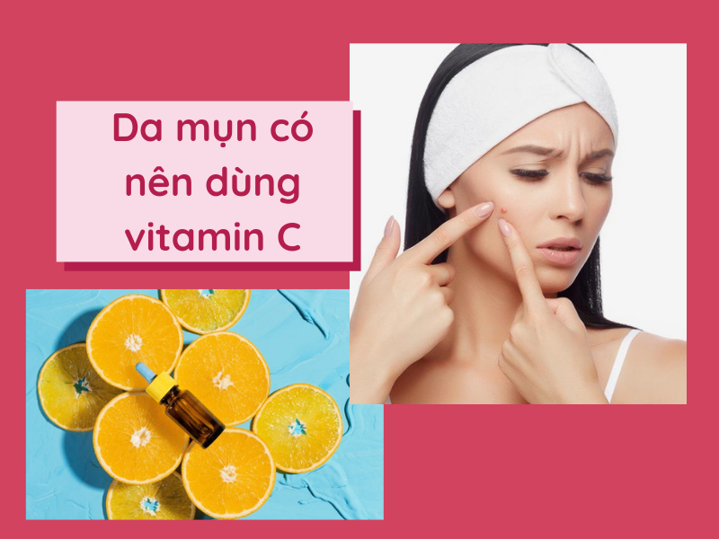 Bị mụn có nên uống vitamin c không? 